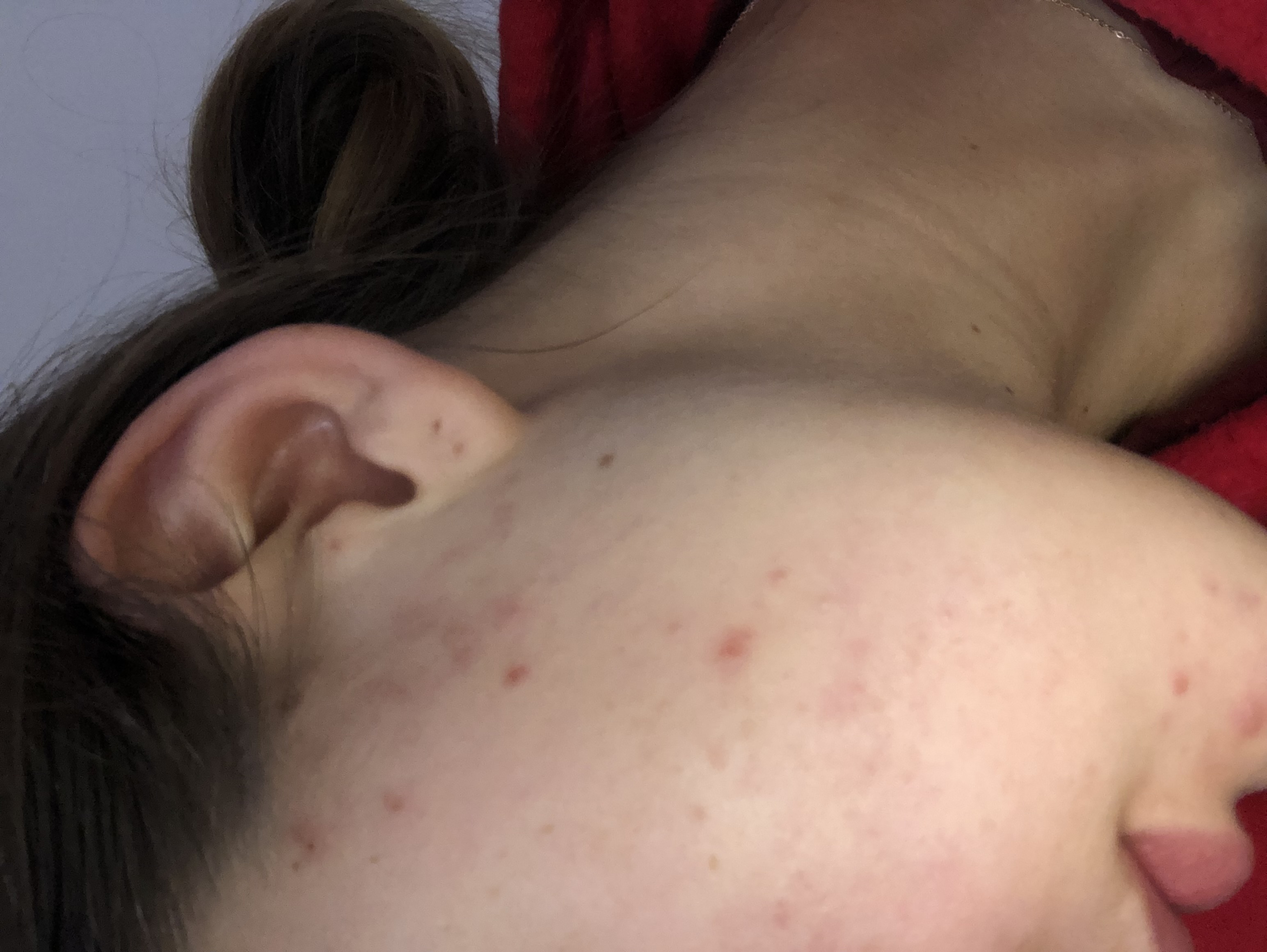 Marias Verwandlung — Haut — Raupe
